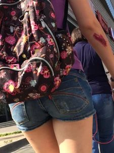 Cute Teen With an Injured Leg Creepshots in a Bus and on a Crosswalk