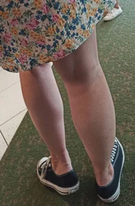 Legs Closeup - Young Girl in a Dress