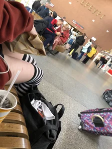 Skinny candid girl with scarred legs in stockings having a snack creepshots