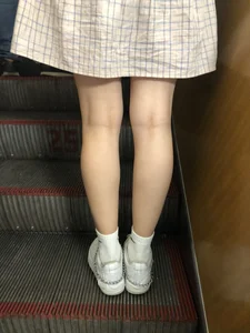 Cute Girl in a Dress with Thin Hot Legs Standing on the Subway Escalator Closeup Creepshots Gallery