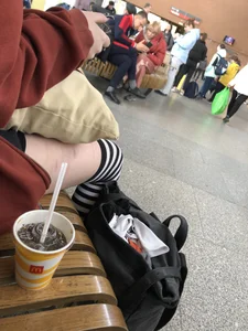 Skinny candid girl with scarred legs in stockings having a snack creepshots