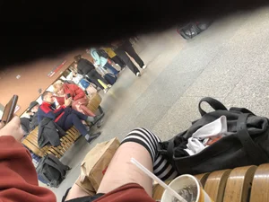 Skinny candid girl with scarred legs in stockings having a snack creepshots