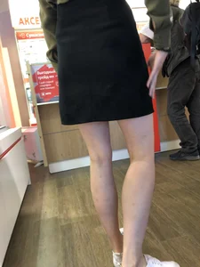 Girl with Pale Skinny Legs in a Skirt Candid