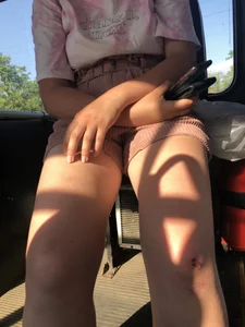 Young Girl in Sandals and Shorts in a Public Bus