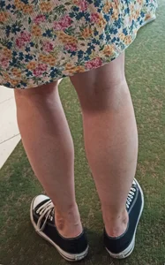 Legs Closeup - Young Girl in a Dress