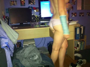 Topless Girl in Panties with a Broken Arm Walking Around Her Room Creepshots