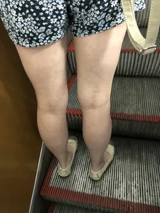 Girl in Short Dress with Cute Skinny Legs Hot Subway Candid