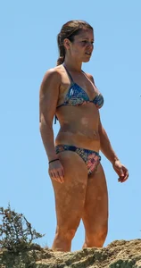 Sexy girl with skin condition in blue bikini