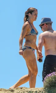 Sexy girl with skin condition in blue bikini