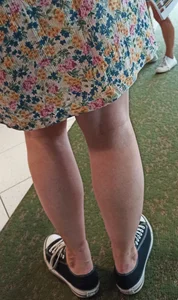Legs Closeup - Young Girl in a Dress