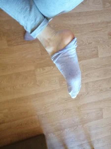Closeup of a teen girl's foot with a pulled down sock