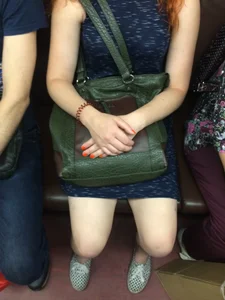 Hot Redhead in a Dress with Bruisers on Her Legs Hot Subway Creepshots