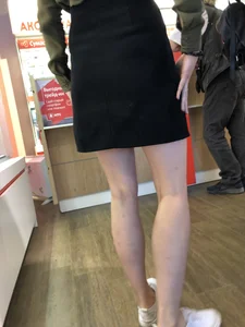 Girl with Pale Skinny Legs in a Skirt Candid