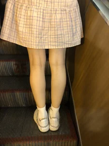 Cute Girl in a Dress with Thin Hot Legs Standing on the Subway Escalator Closeup Creepshots Gallery