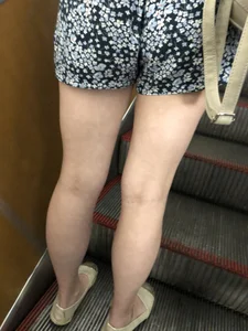 Girl in Short Dress with Cute Skinny Legs Hot Subway Candid