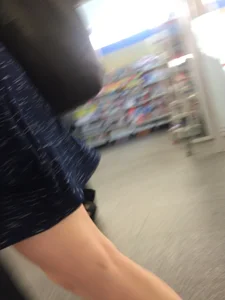Hot Redhead in a Dress with Bruisers on Her Legs Hot Subway Creepshots