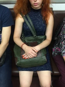 Hot Redhead in a Dress with Bruisers on Her Legs Hot Subway Creepshots