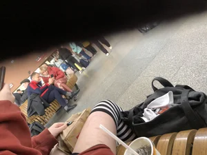 Skinny candid girl with scarred legs in stockings having a snack creepshots