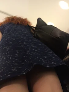 Hot Redhead in a Dress with Bruisers on Her Legs Hot Subway Creepshots