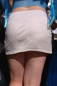 Chavvy Milf in Miniskirt and Weird Top at the Market