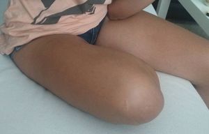 Closeup of a candid girl's skinny legs - she's sitting wearing panties