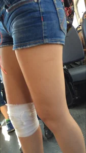 Candid bus teen with a bandaged knee wearing denim shorts with hot slim legs creepshots