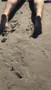 Beach follow-up (non-oc)