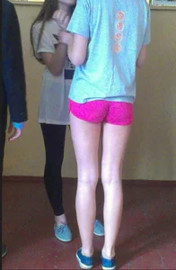 Skinny Legs in Pink Shorts Candid